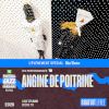 Angine de Poitrine
